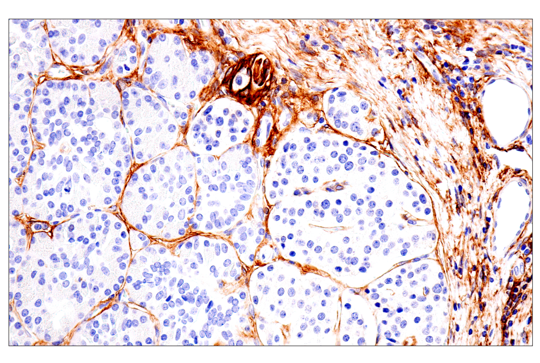 Immunohistochemistry Image 10: p75NTR (E7I3M) Rabbit mAb