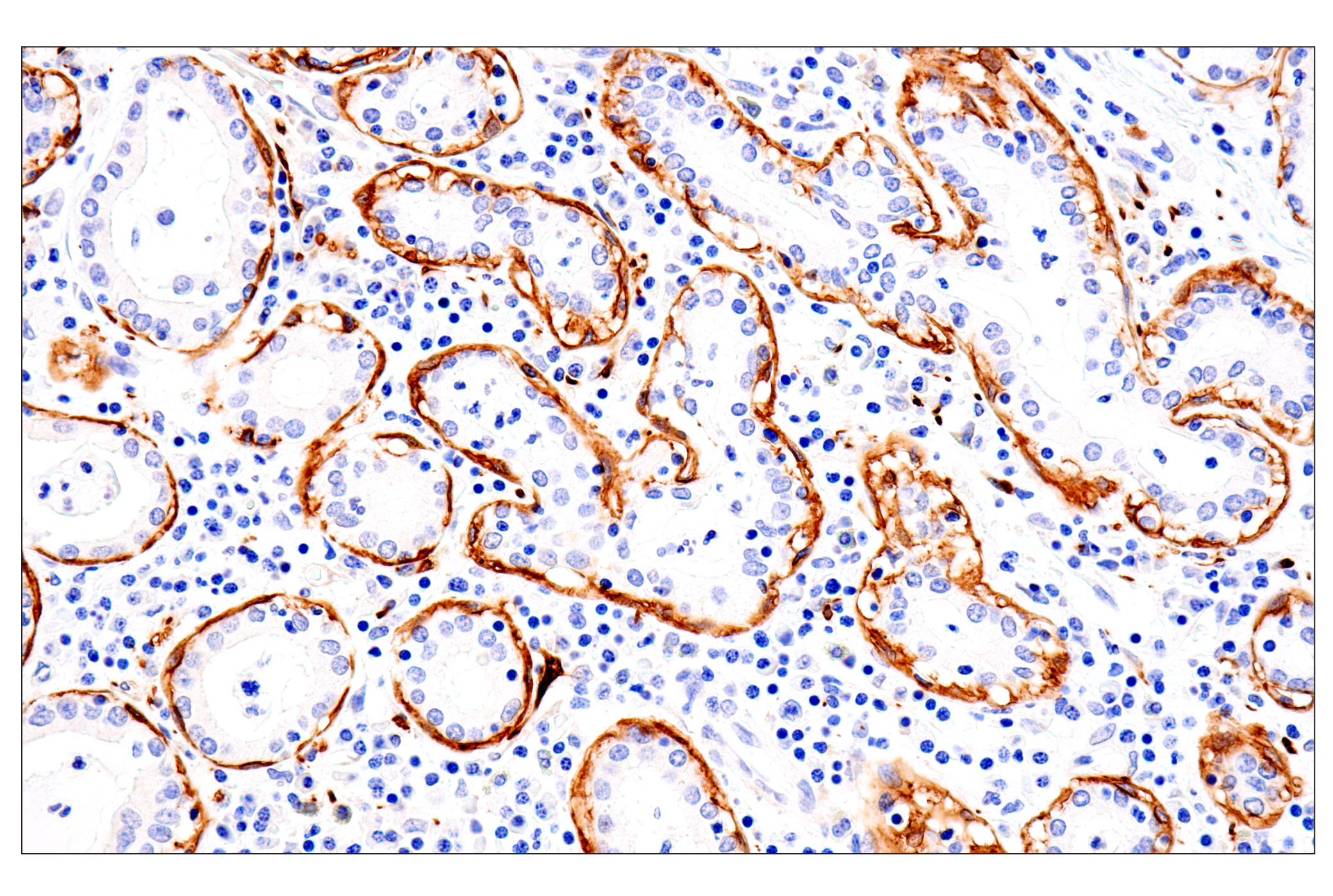 Immunohistochemistry Image 4: p75NTR (E7I3M) Rabbit mAb
