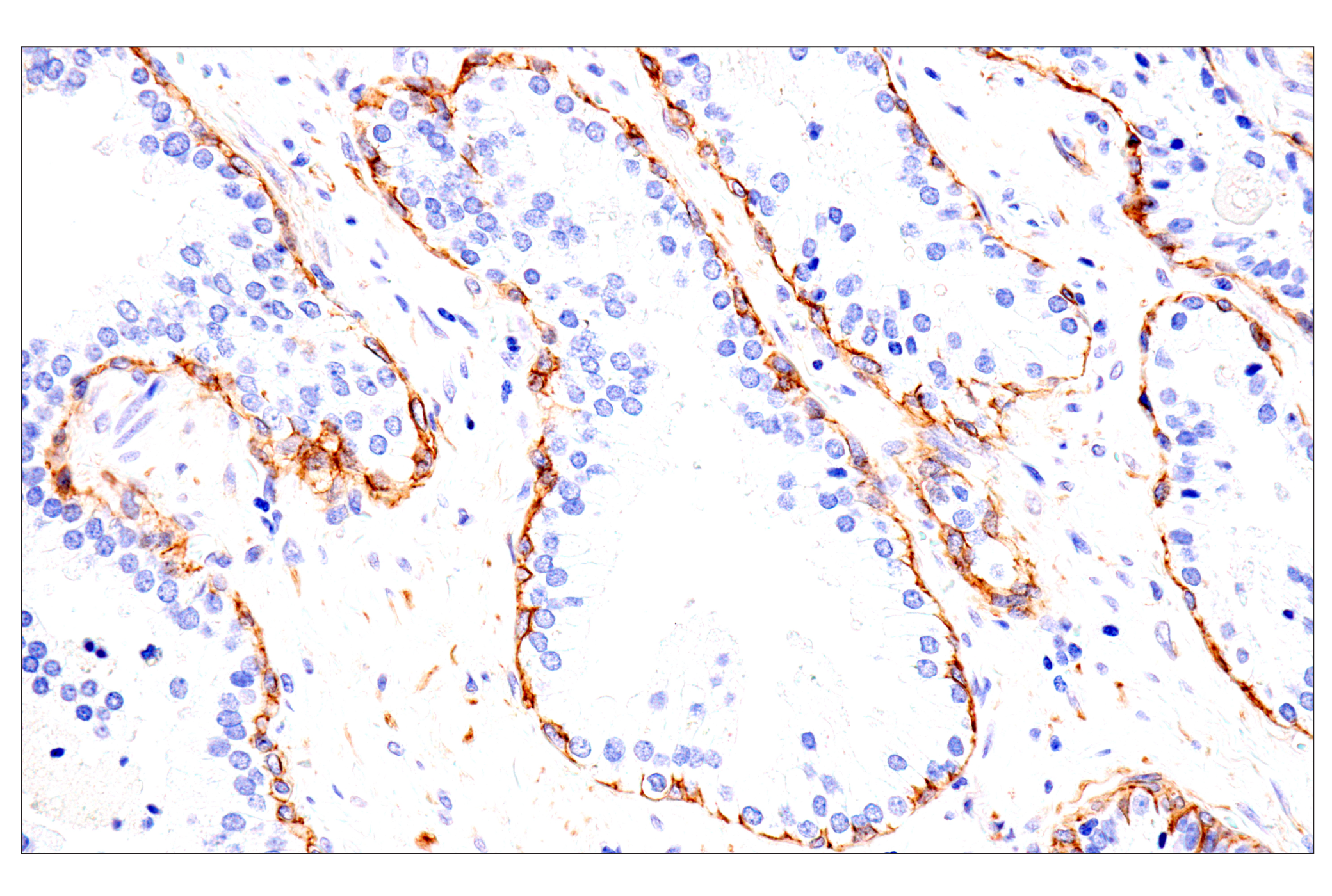 Immunohistochemistry Image 2: p75NTR (E7I3M) Rabbit mAb