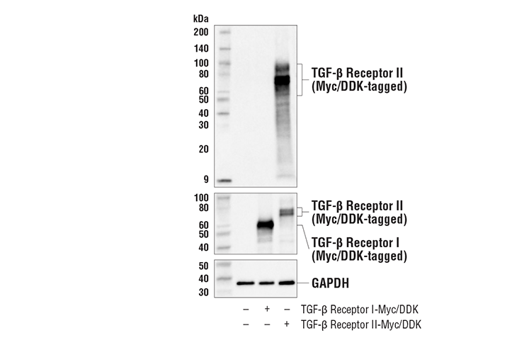 Western Blotting Image 1: TGF-β Receptor II (E5M6F) Rabbit mAb