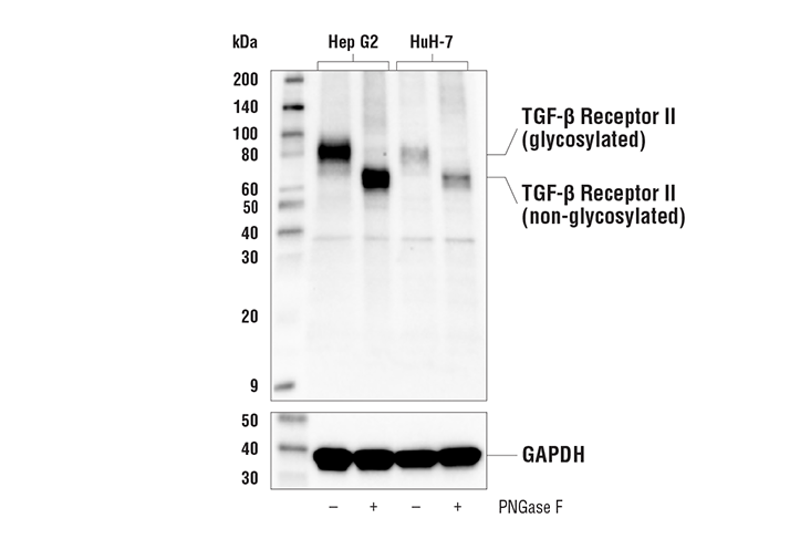 Western Blotting Image 2: TGF-β Receptor II (E5M6F) Rabbit mAb