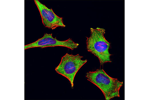 Immunofluorescence Image 1: YB1 (D299) Antibody