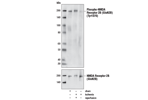 Western Blotting Image 1: Phospho-NMDA Receptor 2B (GluN2B) (Tyr1070) Antibody