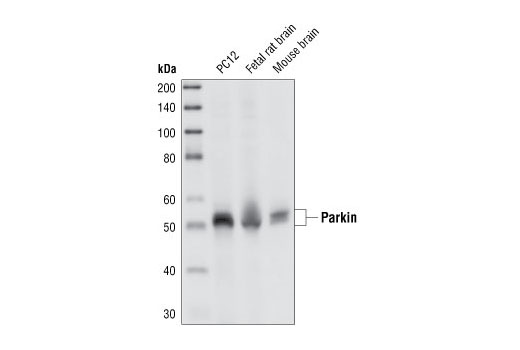  Image 4: Parkinson's Research Antibody Sampler Kit