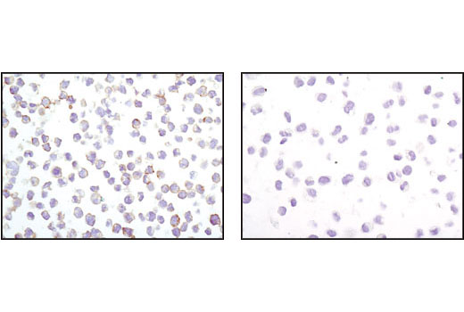 Immunohistochemistry Image 3: Fas (C18C12) Rabbit mAb