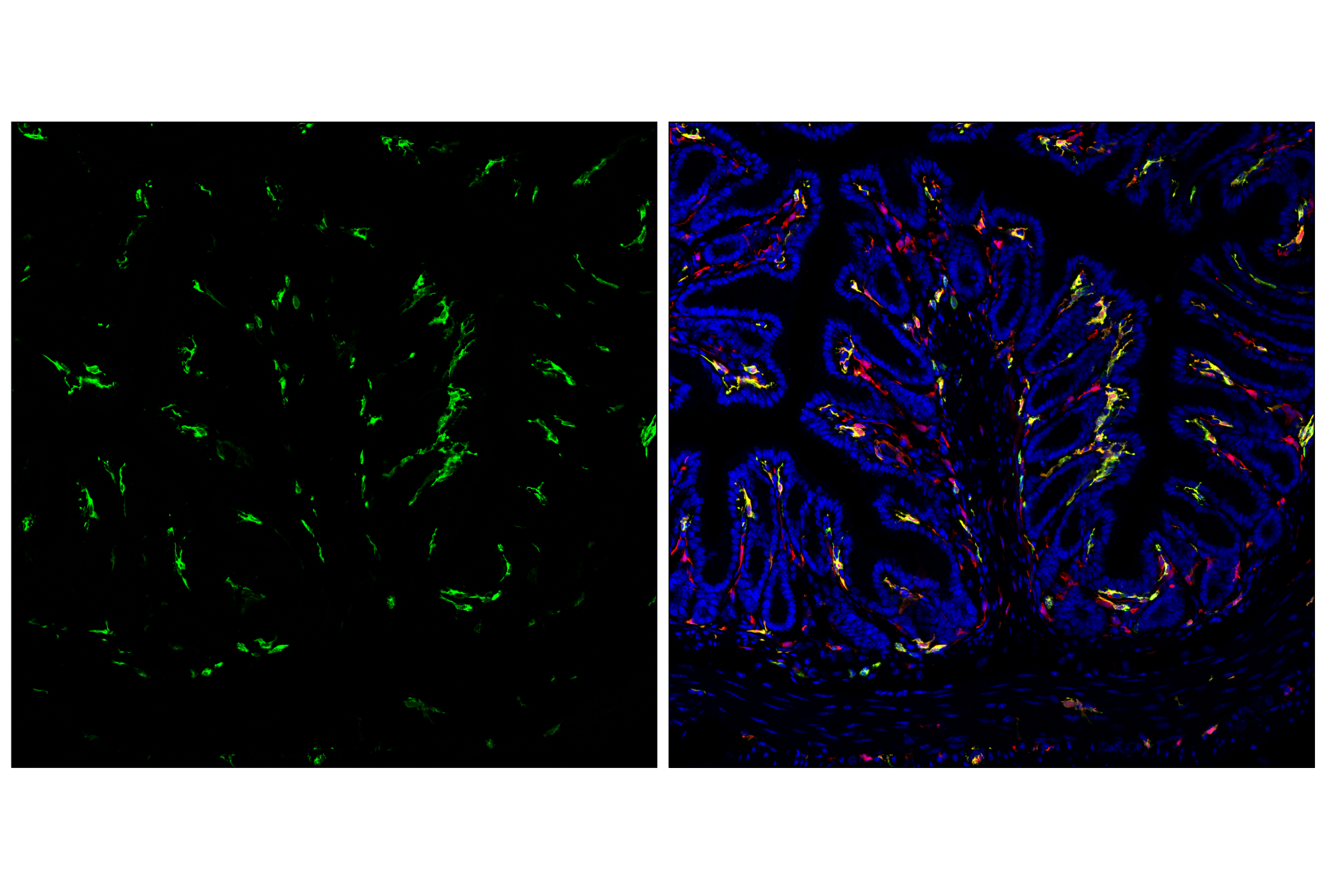 Immunofluorescence Image 3: MHC Class II (I-A/I-E) (M5/114.15.2) Rat mAb (FITC Conjugate)