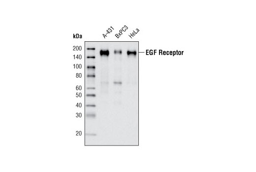  Image 11: Phospho-EGF Receptor Antibody Sampler Kit