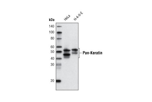 Western Blotting Image 1: Pan-Keratin (C11) Mouse mAb (Biotinylated)
