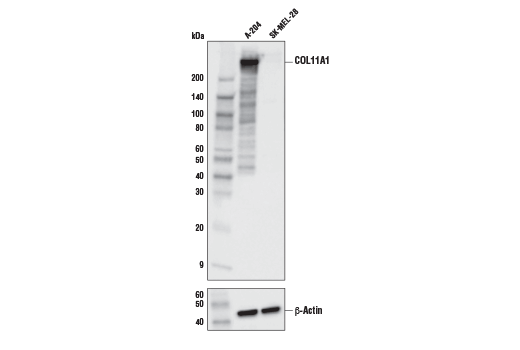 Western Blotting Image 1: COL11A1 Antibody