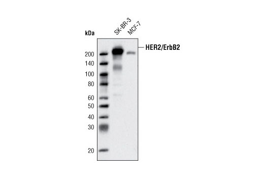  Image 12: HER/ErbB Family Antibody Sampler Kit