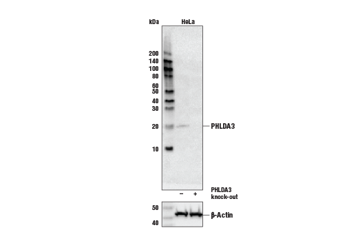  Image 1: PHLDA3 Antibody