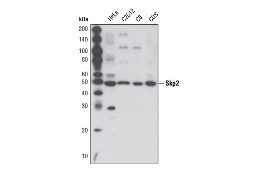 Western Blotting Image 1: Skp2 (L70) Antibody