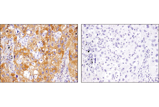Immunohistochemistry Image 3: p130 Cas (E1L9H) Rabbit mAb (BSA and Azide Free)
