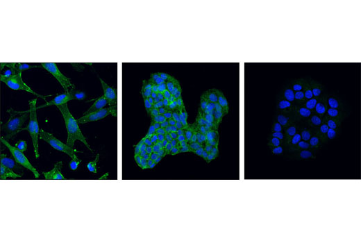 Immunofluorescence Image 1: Mer (D21F11) XP® Rabbit mAb