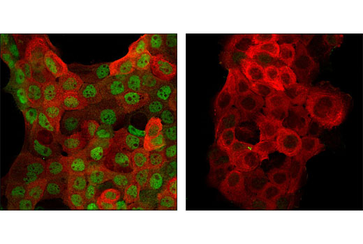Immunofluorescence Image 1: Phospho-Stat5 (Tyr694) (D47E7) XP® Rabbit mAb (BSA and Azide Free)