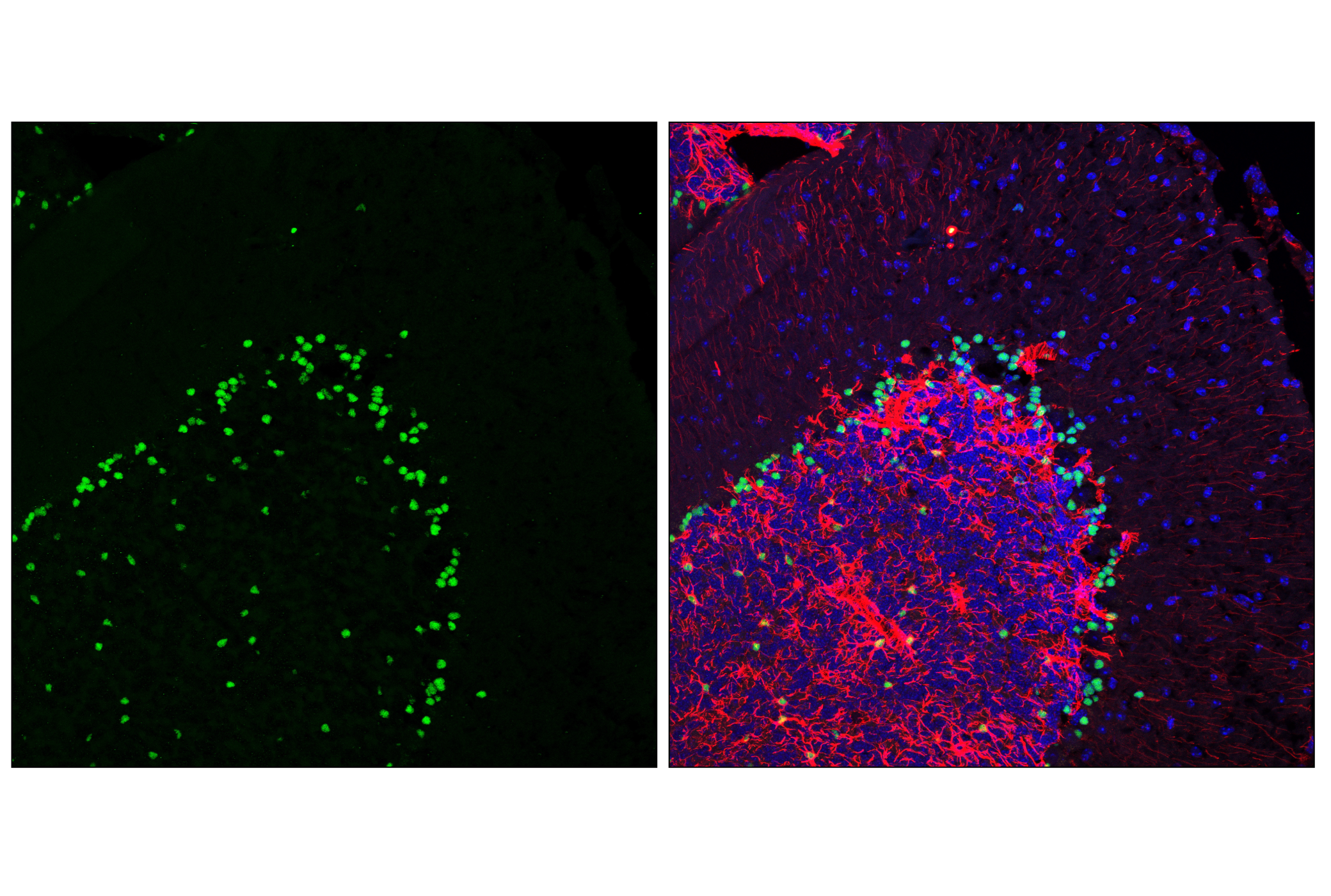 Immunofluorescence Image 1: Sox2 (E4I2X) Rabbit mAb