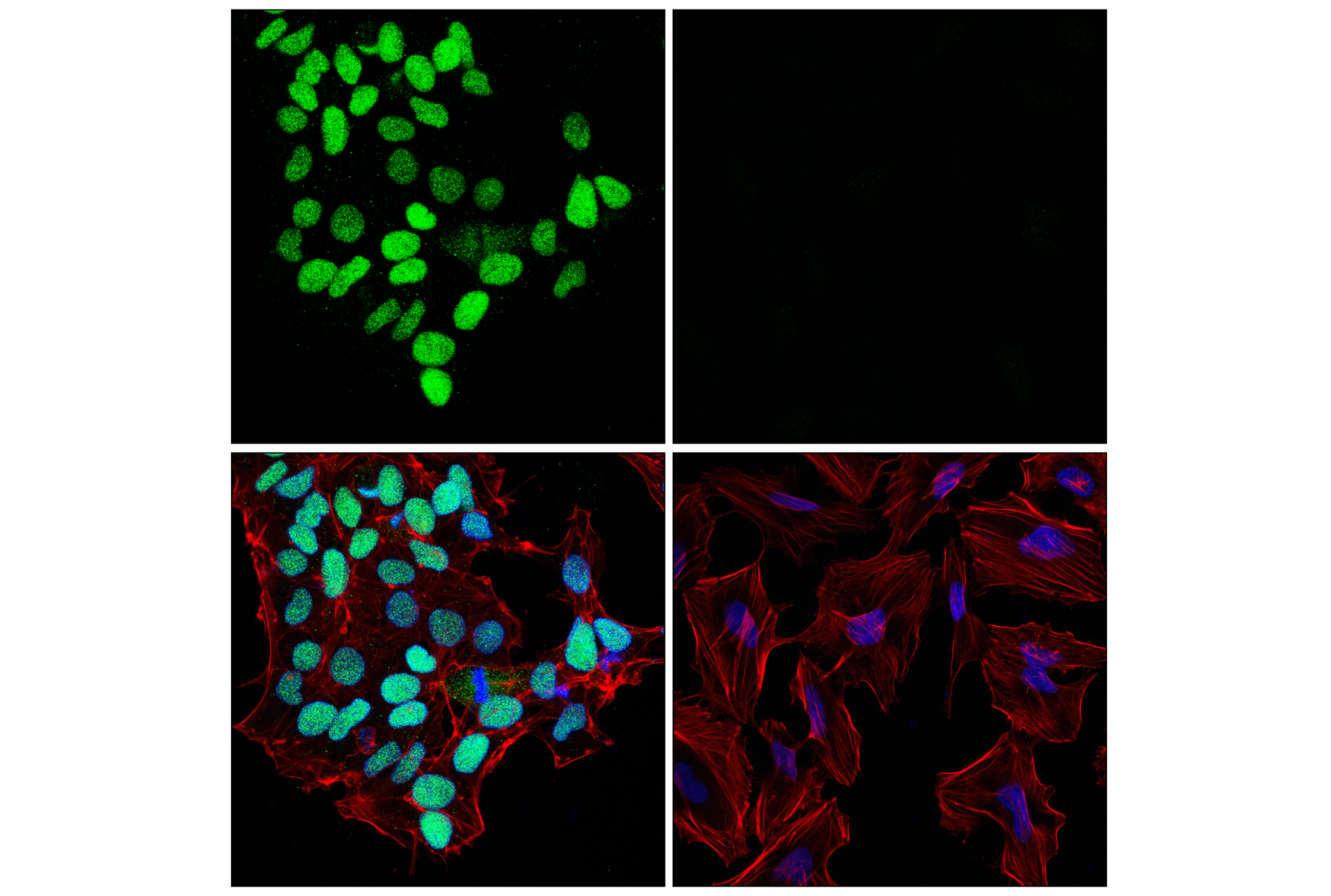 Immunofluorescence Image 2: Sox2 (E4I2X) Rabbit mAb
