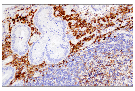 Immunohistochemistry Image 4: CD38 (E7Z8C) XP® Rabbit mAb (BSA and Azide Free)