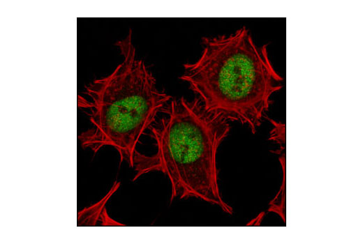 Immunofluorescence Image 1: Pbx1 Antibody