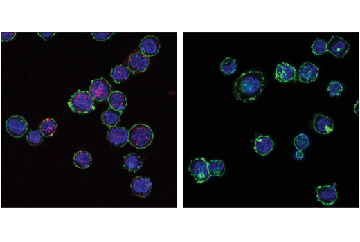 Immunofluorescence Image 1: Phospho-STING (Ser366) (D8K6H) Rabbit mAb (Alexa Fluor® 647 Conjugate)