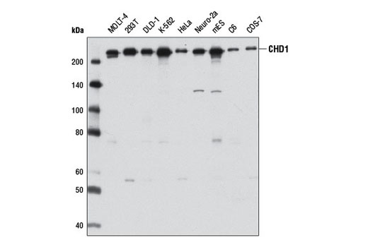  Image 5: Chromodomain Helicase DNA-Binding (CHD) Family Antibody Sampler Kit