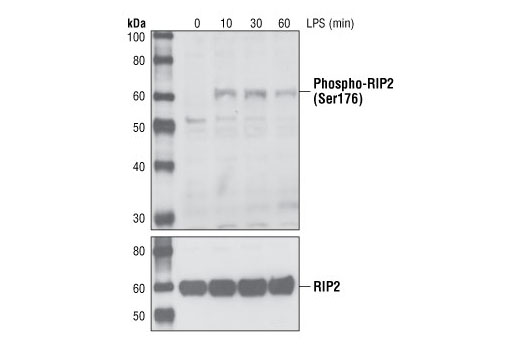 Western Blotting Image 1: Phospho-RIP2 (Ser176) Antibody