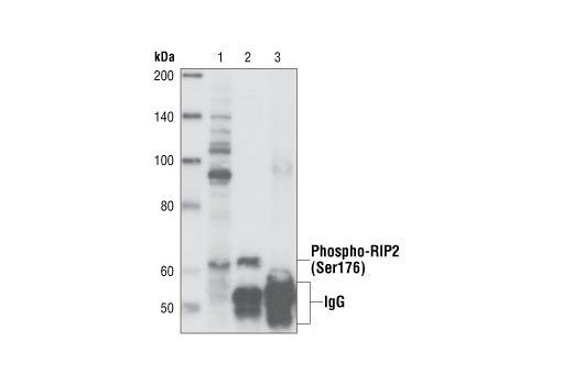 Immunoprecipitation Image 1: Phospho-RIP2 (Ser176) Antibody