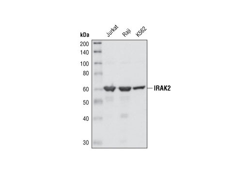 Western Blotting Image 1: IRAK2 Antibody