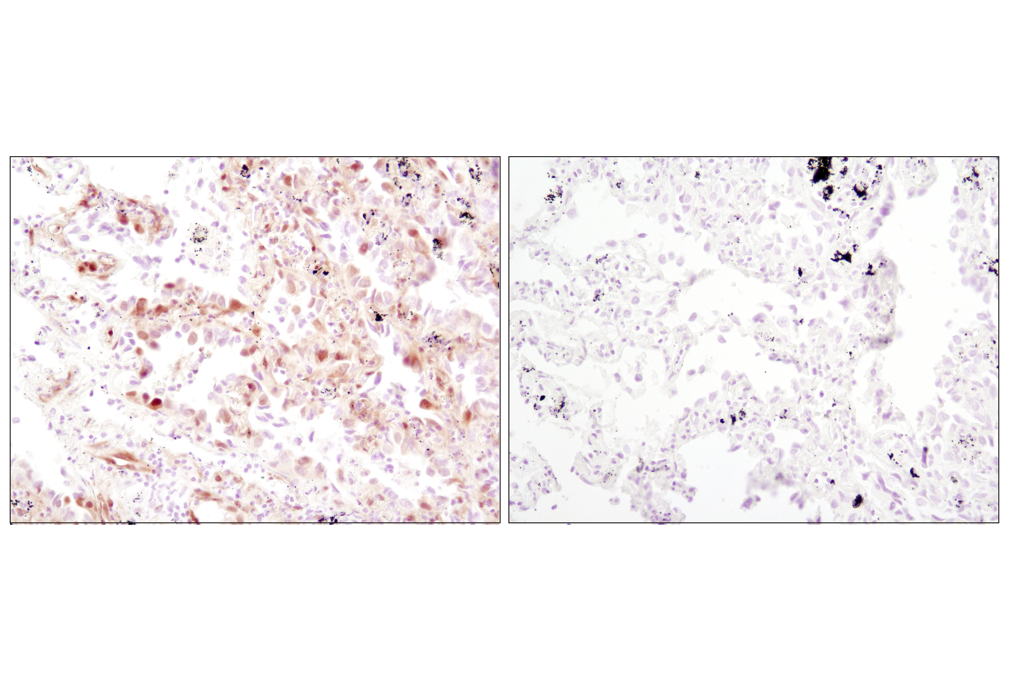  Image 12: PhosphoPlus® p44/42 MAPK (Erk1/2) (Thr202/Tyr204) Antibody Kit
