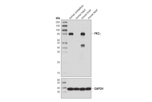 Western Blotting Image 1: PKCγ Antibody