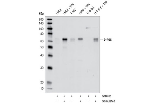  Image 2: Fos Family Antibody Sampler Kit