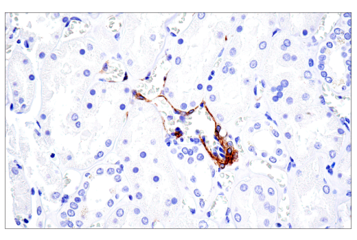Immunohistochemistry Image 5: NG2/CSPG4 (E3B3G) XP® Rabbit mAb