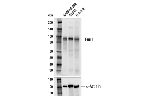 Western Blotting Image 1: Furin Antibody