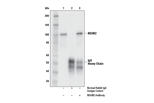 Immunoprecipitation Image 1: NSUN2 Antibody