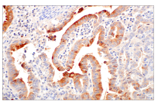 Immunohistochemistry Image 1: LCN2 (D4M8L) Rabbit mAb