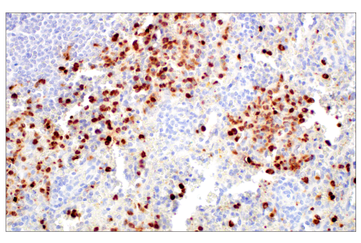 Immunohistochemistry Image 9: LCN2 (D4M8L) Rabbit mAb