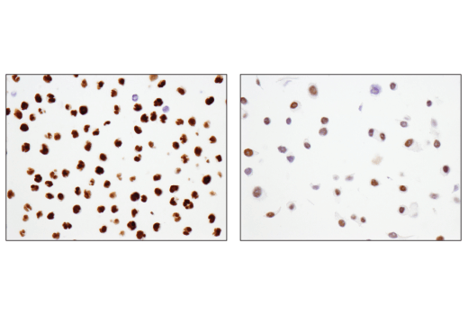 Immunohistochemistry Image 1: ATF-2 (D4L2X) XP® Rabbit mAb (BSA and Azide Free)