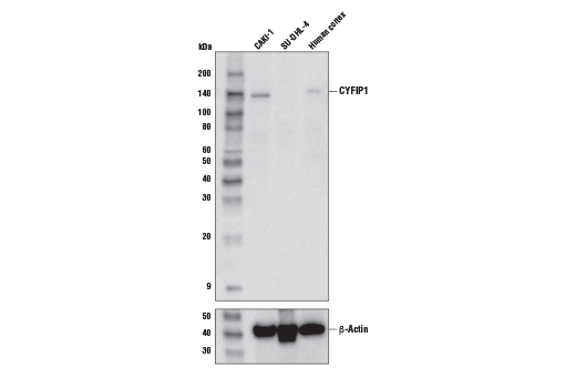 Western Blotting Image 1: CYFIP1 Antibody