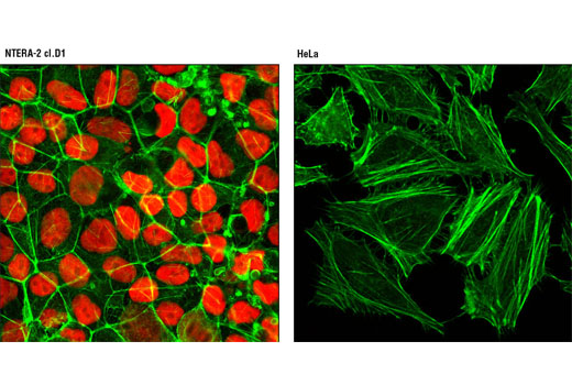 Immunofluorescence Image 1: Oct-4A (C30A3) Rabbit mAb (Alexa Fluor® 555 Conjugate)