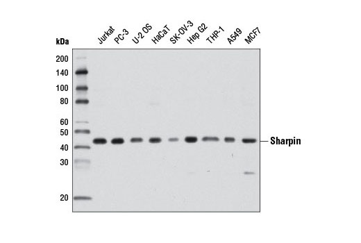 Western Blotting Image 2: Sharpin Antibody