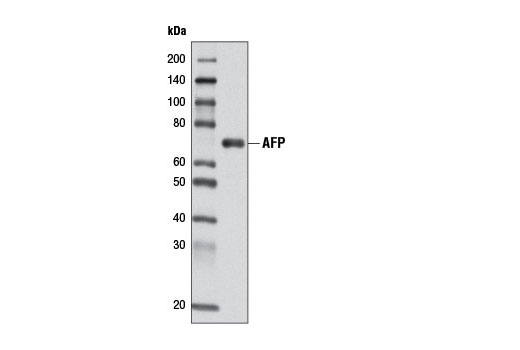  Image 3: Endodermal Lineage Marker Antibody Sampler Kit