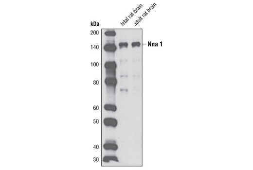 Western Blotting Image 1: Nna1 Antibody