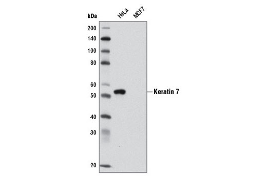 Western Blotting Image 1: Keratin 7 (D1E4) XP® Rabbit mAb