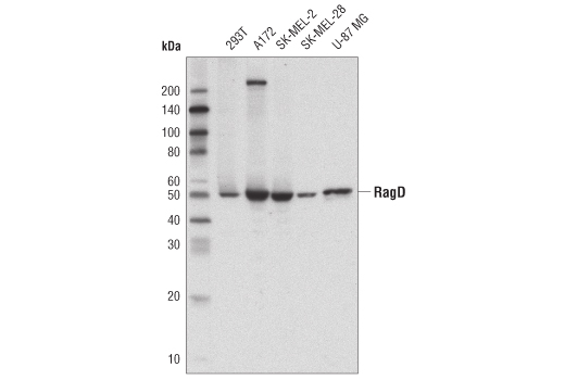  Image 6: Rag Protein Antibody Sampler Kit