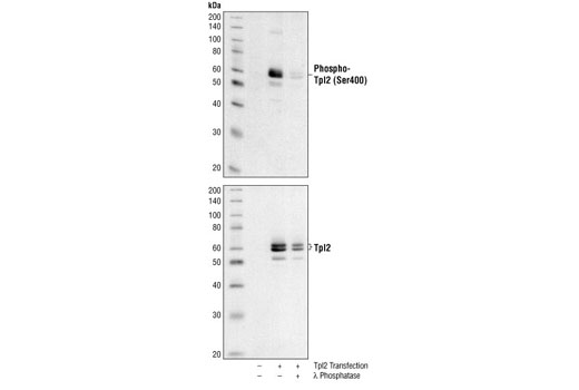 Western Blotting Image 1: Phospho-Tpl2 (Ser400) Antibody