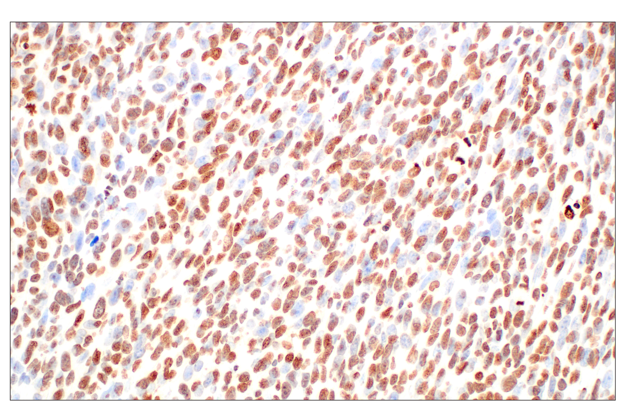 Immunohistochemistry Image 2: Histone H3 (D1H2) XP® Rabbit mAb