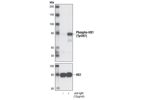 Western Blotting Image 1: Phospho-HS1 (Tyr397) Antibody