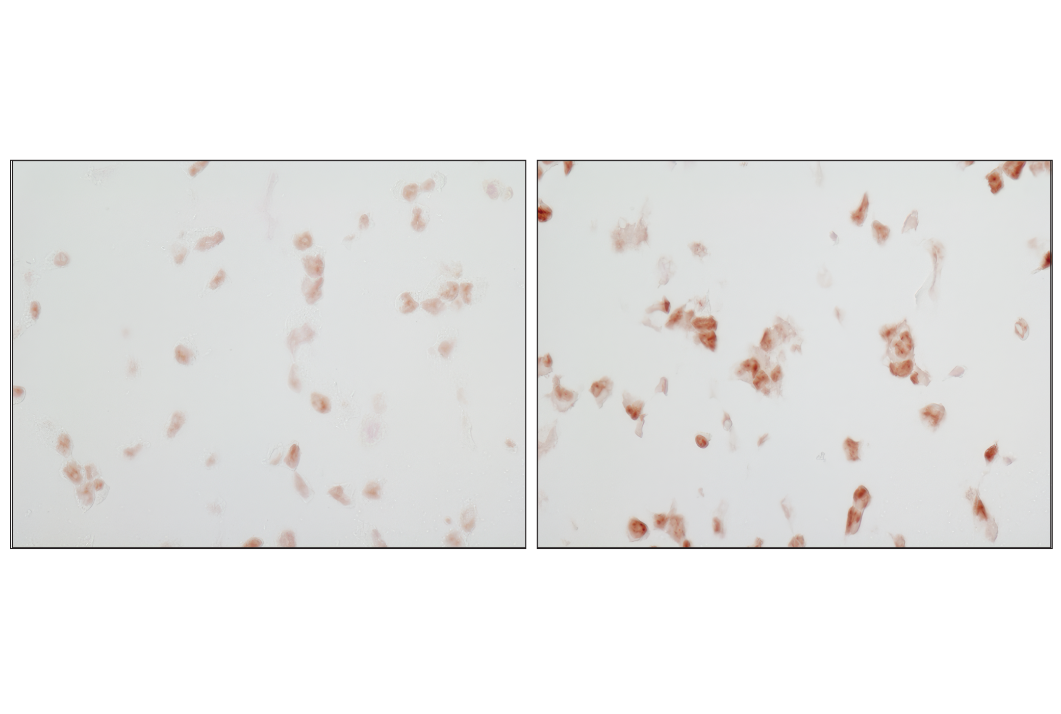  Image 7: PhosphoPlus® p38 MAPK (Thr180/Tyr182) Antibody Duet