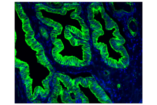 Immunohistochemistry Image 1: Pan-Keratin (C11) Mouse mAb (Alexa Fluor® 488 Conjugate)