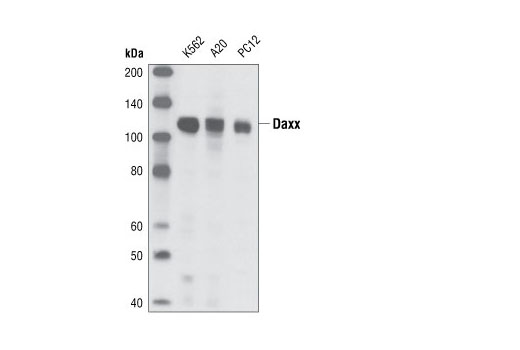  Image 5: ATRX/Daxx Antibody Sampler Kit